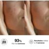 BIO10 FORTE NORMAL SECA 3